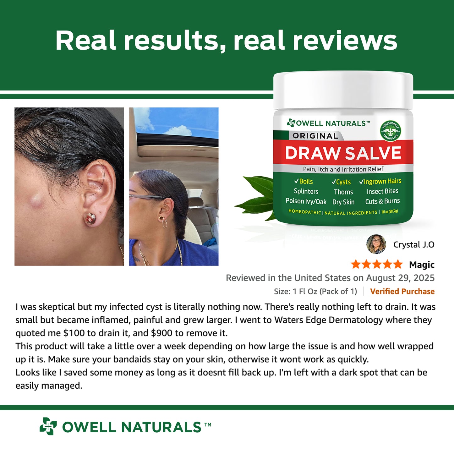 OWELL NATURALS Drawing Salve Ointment 1oz, ingrown Hair Treatment, Boil & Cyst, Splinter Remover, Bug and Spider Bites, bee Sting, Mosquito bite Itch Relief, Poison Ivy